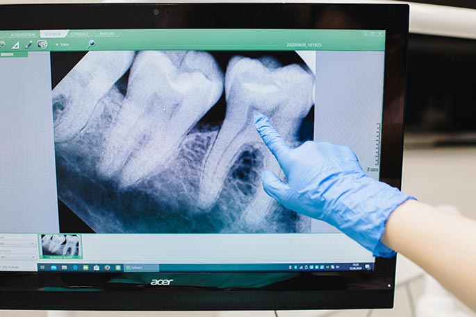 dentist examining xray